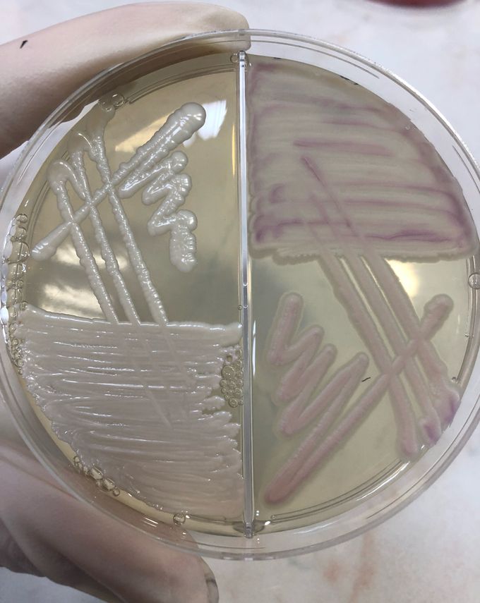 İdentification of Candida species on Chromatic ™ Candida agar