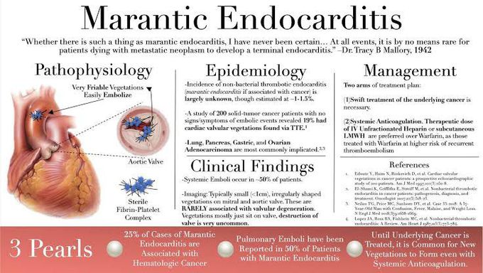 Marantic Endocarditis