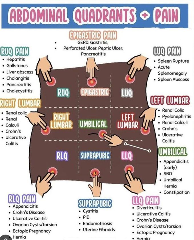 Pain in Abdominal Quadrants