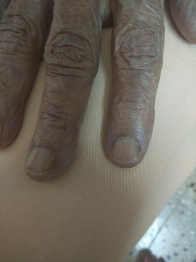 Diagnosis?