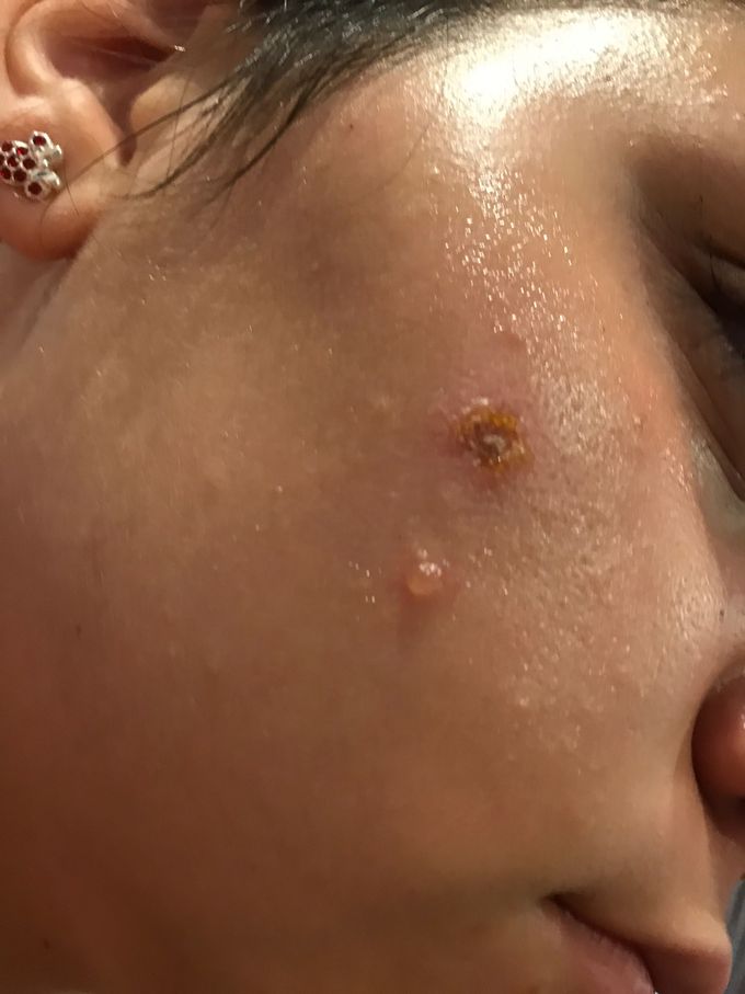 what is this? what’s your diagnosis