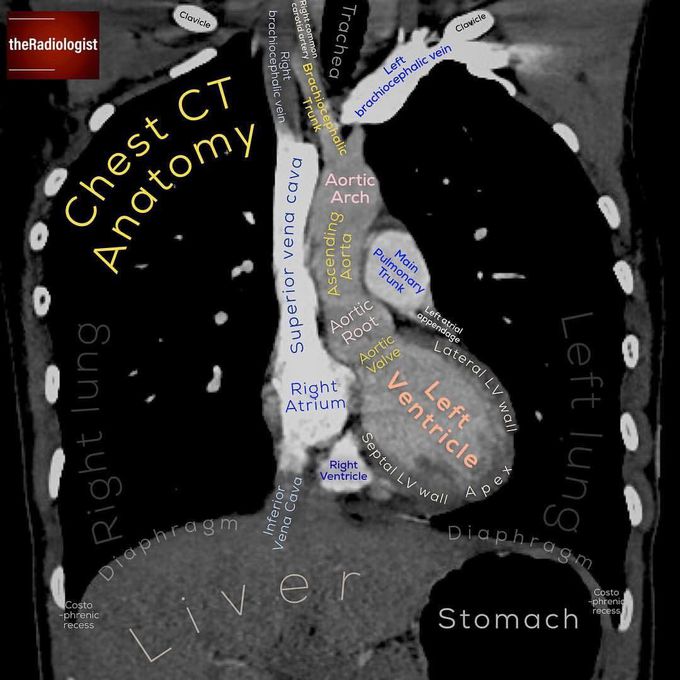 How to learn radiology!