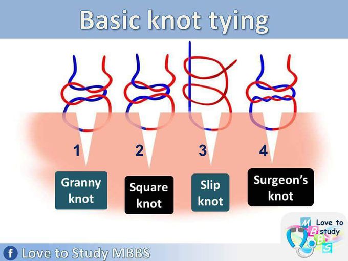 Easy knot