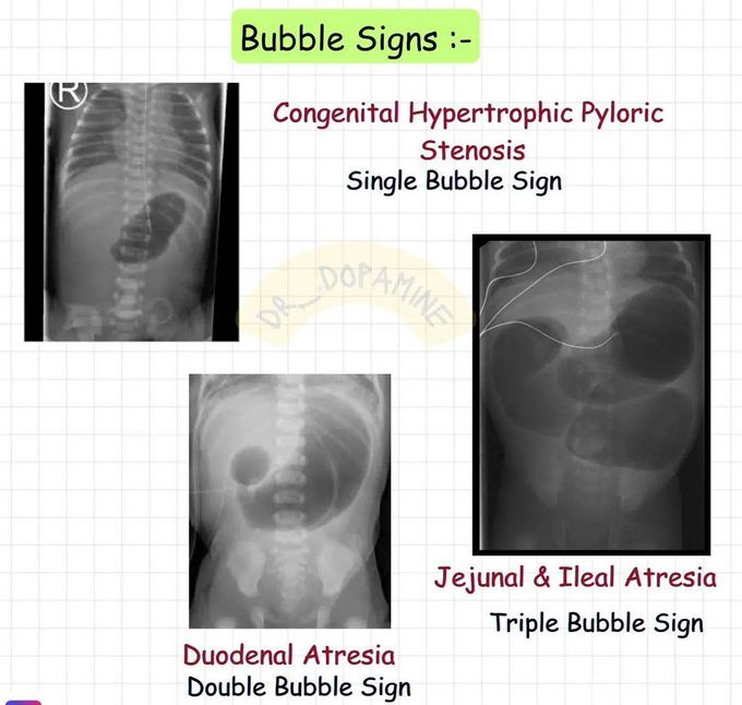 Bubble Signs