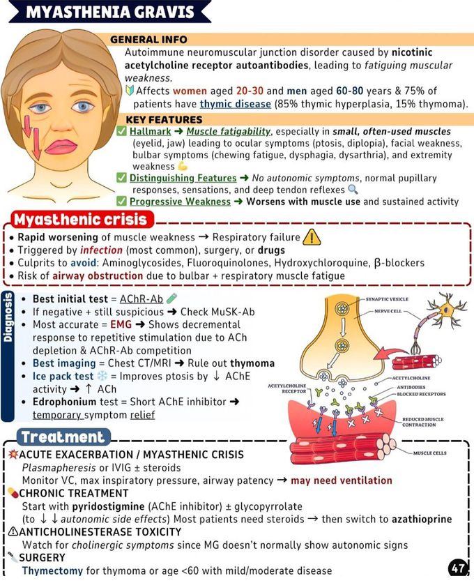 Myasthenia Gravis