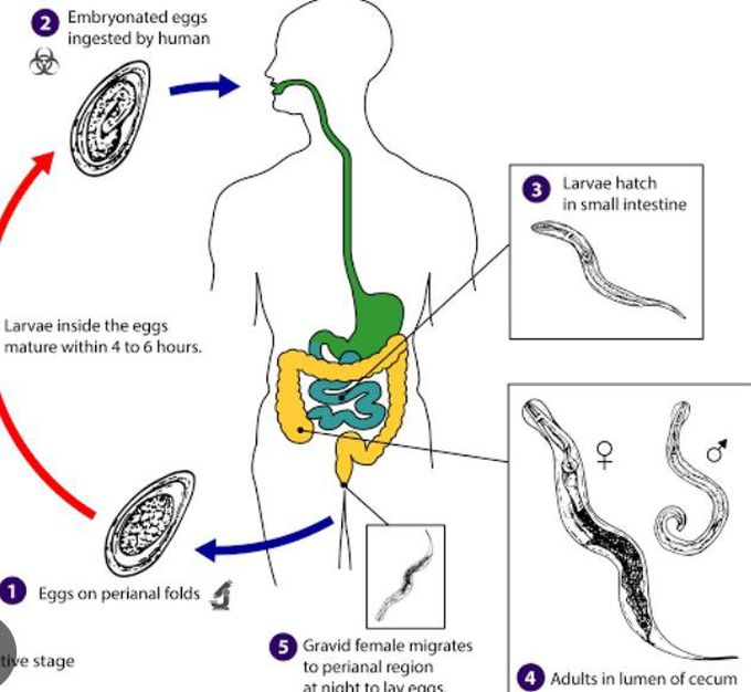 Cause of Enterobiasis