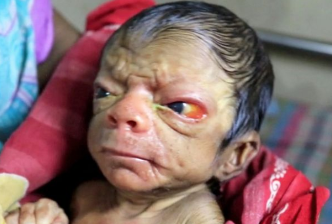 BABY BORN WITH AGING