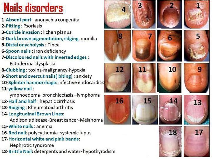 All nail disorders at a glance!