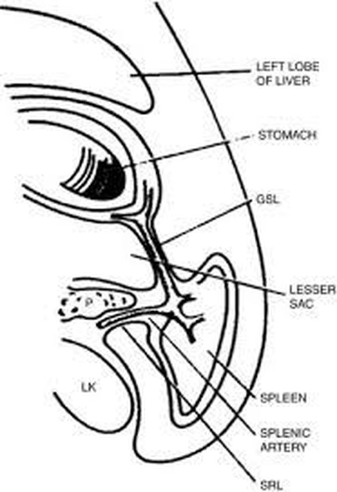 Gastrosplenic ligament