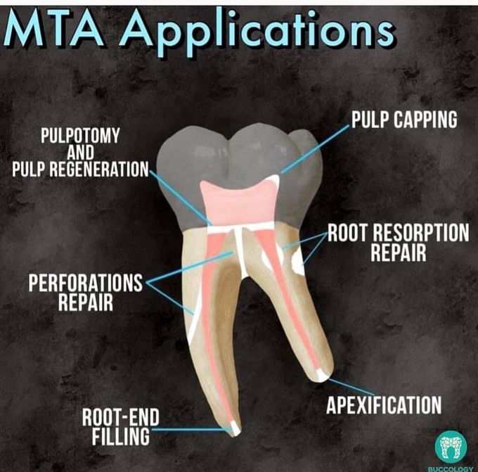 MTA Application