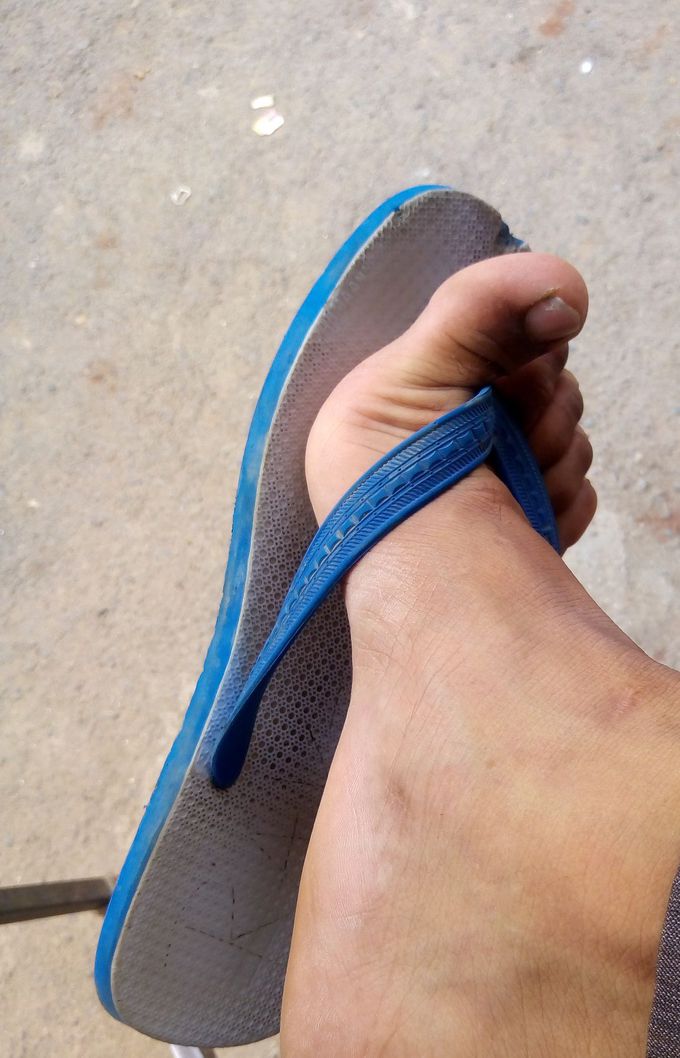 What is your diagnosis