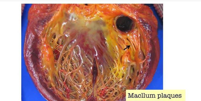 MacCallum Plaques