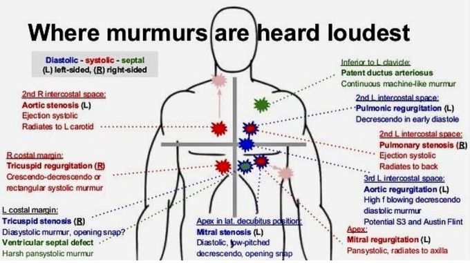Murmurs I