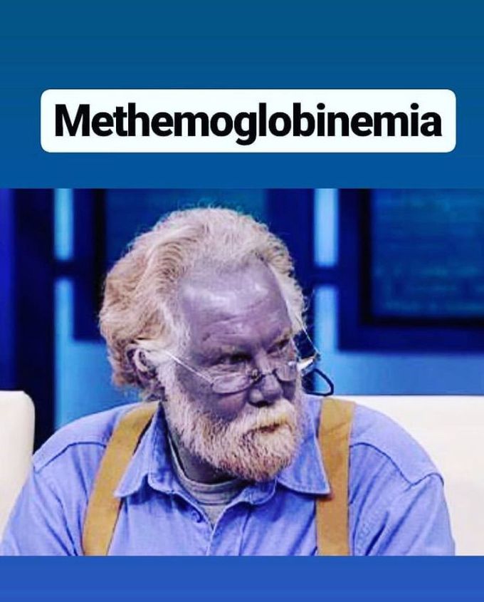 methemiglobinemia