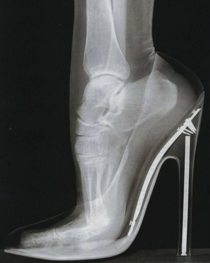 Not so pretty in heels! 