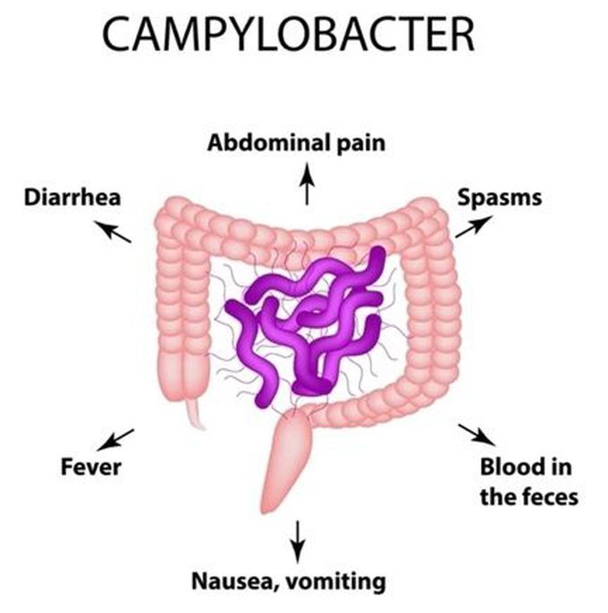 Campylobacter enteritis