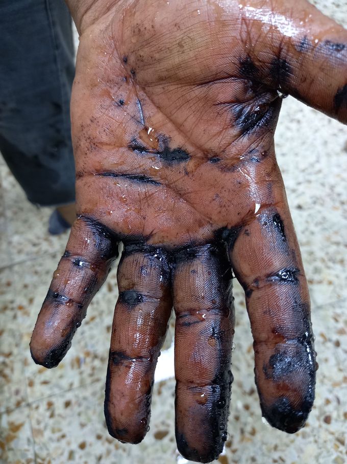 Tar burn