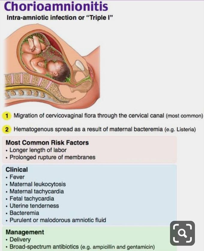 Obstetrics