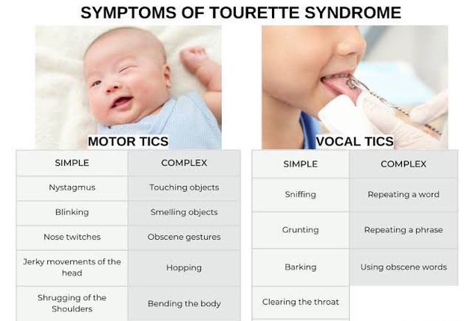 These are the symptoms of Tourettes syndrome