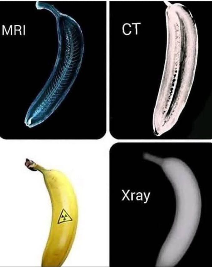 Type of xray