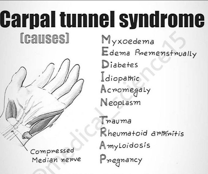 Carpal tunnel syndrome