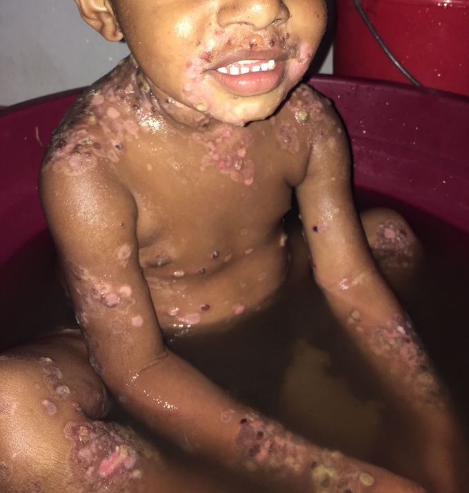 What is your diagnosis ?