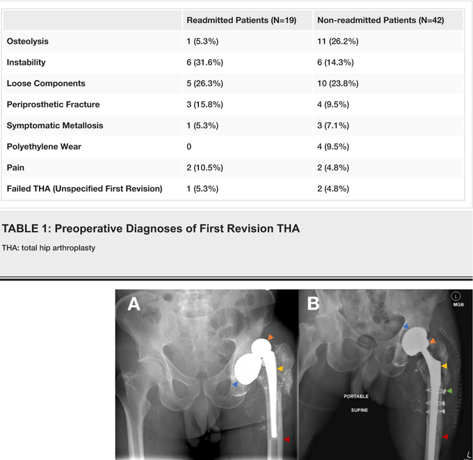 Preoperative Diagnoses of First Revision THA