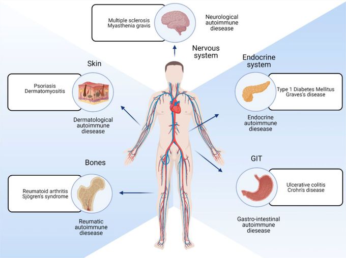 What is an autoimmune disease?