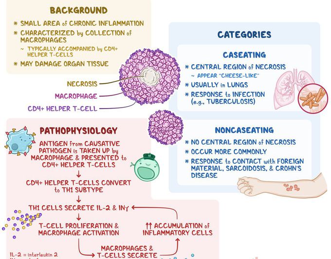 Cause of Granuloma