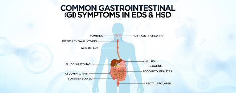 These Are The Symptoms Of Ehler Danlos Syndrome Medizzy 0639