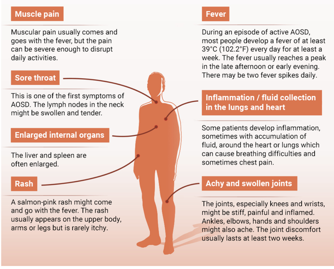 ADULT-ONSET STILLS DISEASE (AOSD)