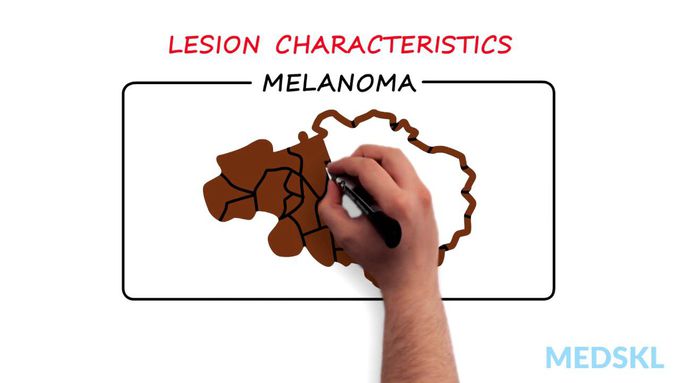 Pathology of skin tumours