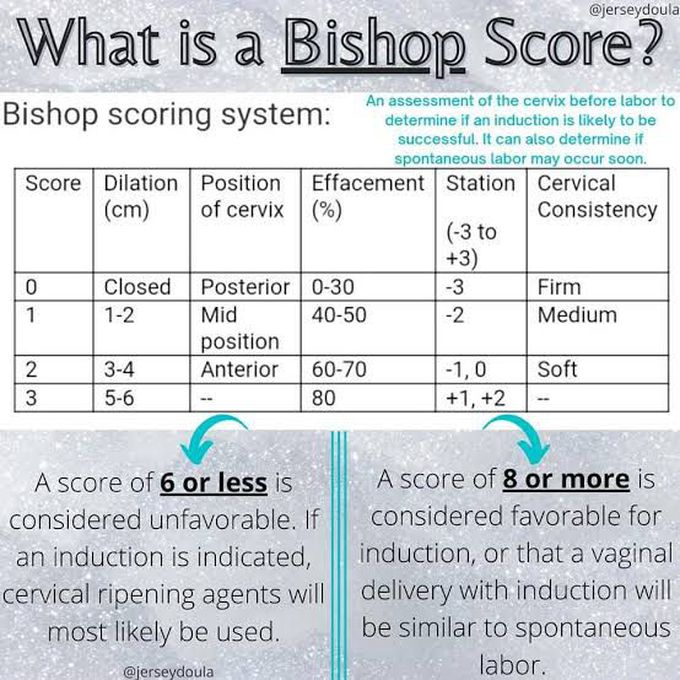 Bishop Score Table