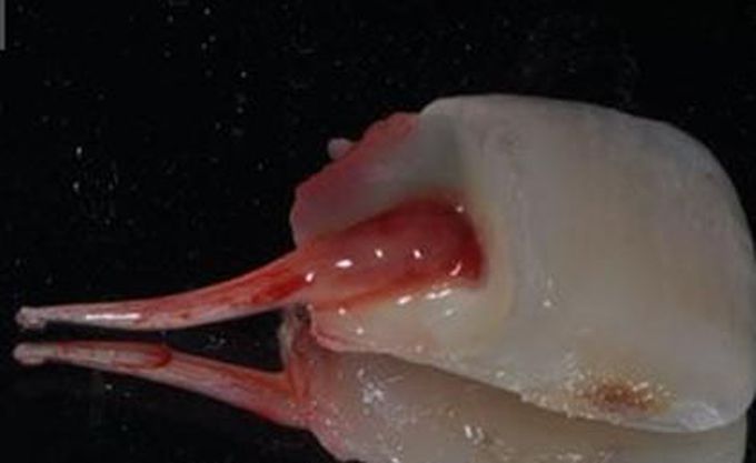 Living pulp tissue