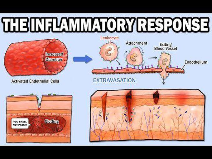 A short guide to Inflammation