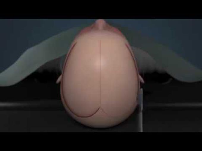 Brain Operation Head