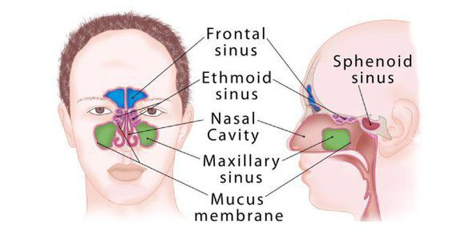 Paranasal sinus