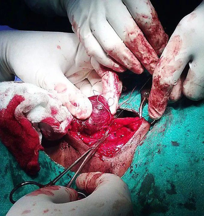 general surgery
