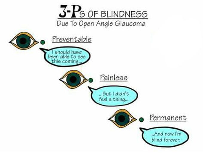Open angle glaucoma
