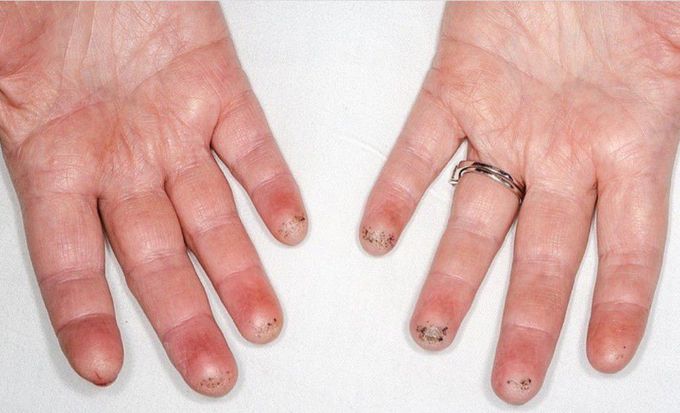 Identify the Pathology