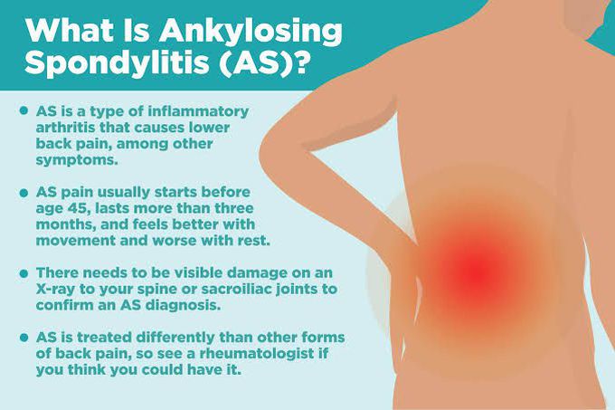 Ankylosing Spondylitis