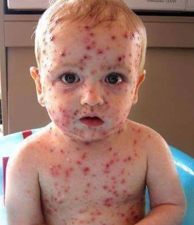 What is your diagnosis ?
