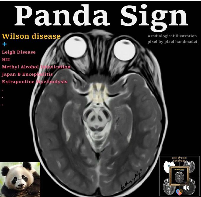 Panda Sign I