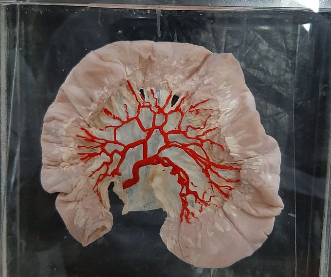 Arterial arcades and vasa recta in ILEUM