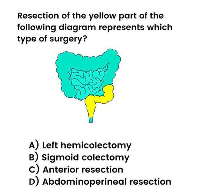 Identify the type of surgery