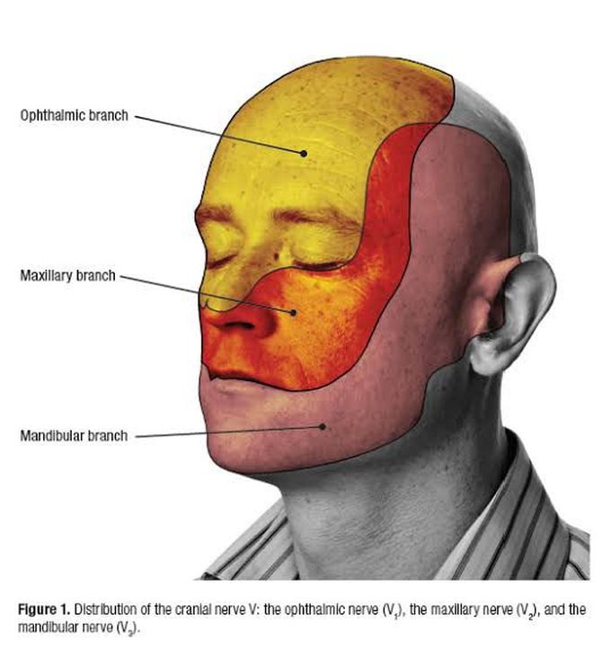 Trigeminal neuralgia