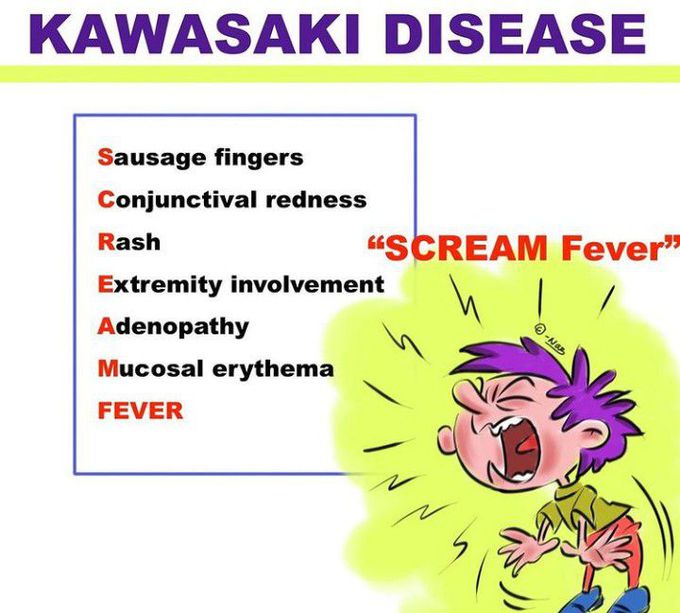 Mnemonic of the Kawasaki disease