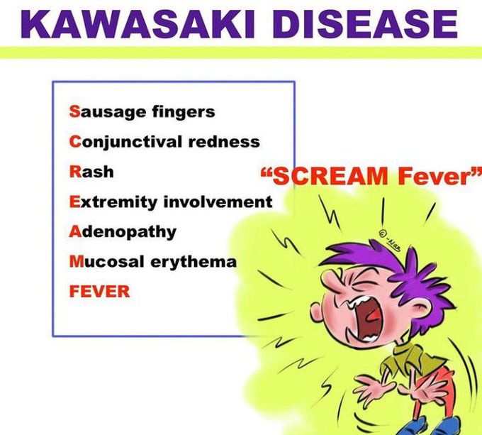 Mnemonic of the Kawasaki disease - MEDizzy