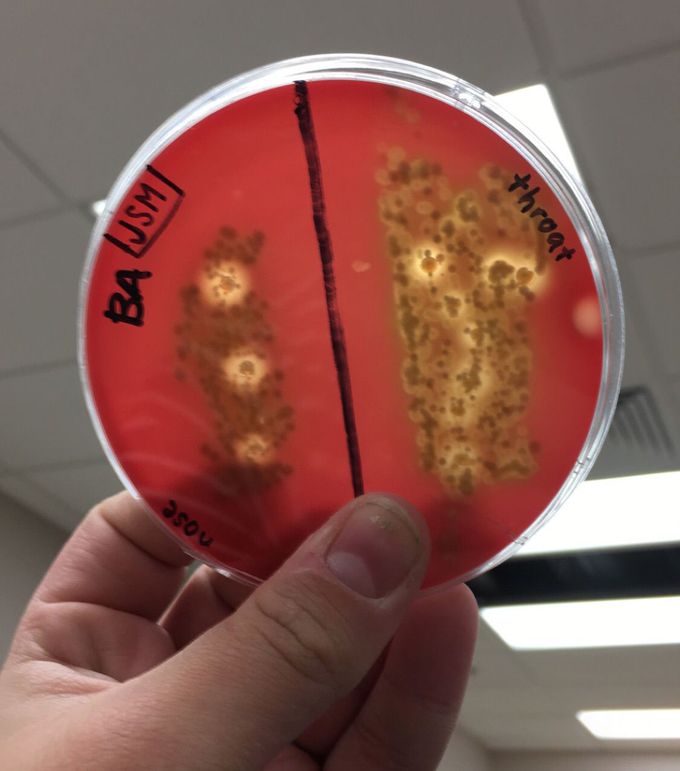 Throat and nose bacteria