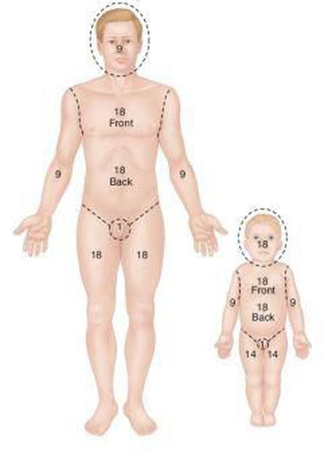 Burn Surface Area